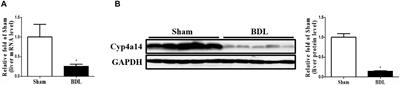 Cytochrome P450 Omega-Hydroxylase 4a14 Attenuates Cholestatic Liver Fibrosis